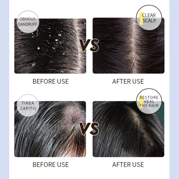 Pure Nourishing & Detox Therapy Anti-dandruff Shampoo - Image 2