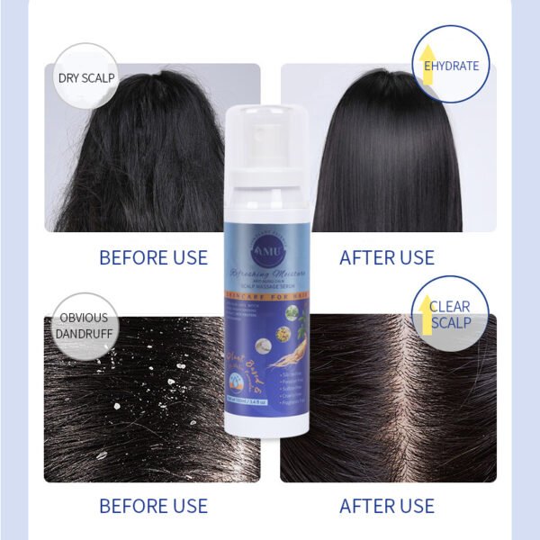 Refreshing Moisture Anti Aging Calm Scalp Massage Serum - Image 3