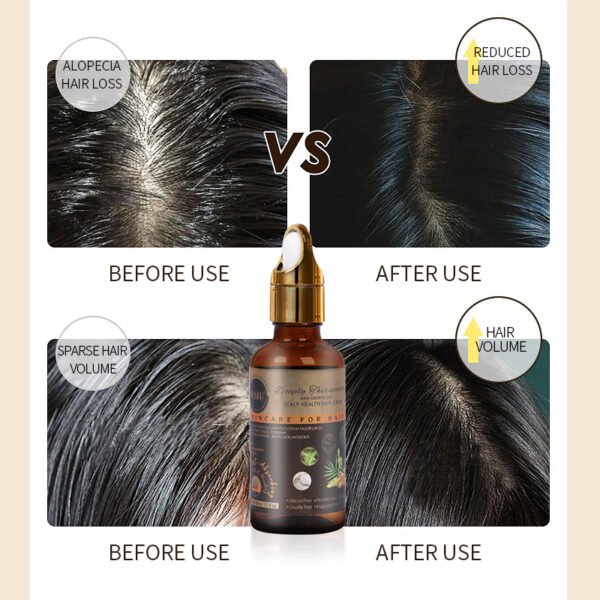 Deeply Therapeutic Hair Growth And Scalp Health Hair Serum - Image 5
